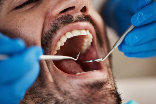 Dental Bonding in Creston, OH